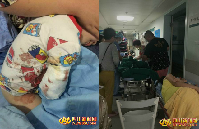 Tin tức trong ngày - TQ: Thò tay vào chuồng hổ, bé 2 tuổi bị cắn đứt cánh tay