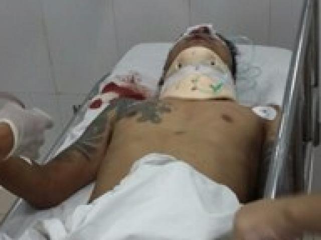 Pháp luật - Giang hồ xách kiếm truy sát thực khách trong nhà hàng