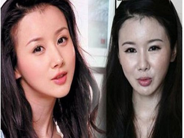 Phim - Những gương mặt đáng sợ của sao vì “dao kéo” hỏng