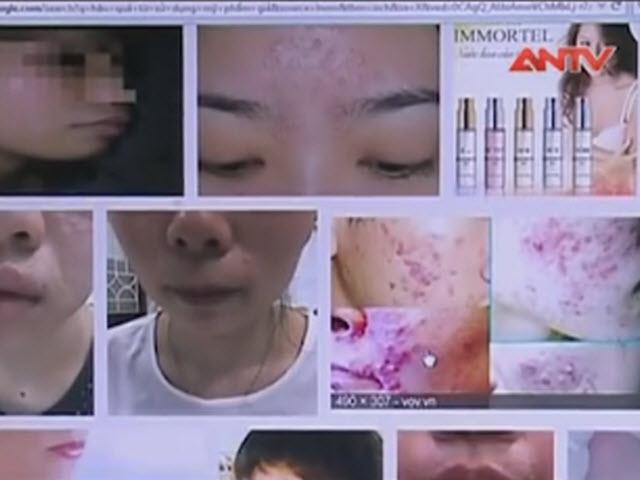 Video An ninh - Hoang mang thị trường mỹ phẩm giả