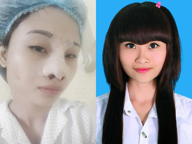 Bạn trẻ - Cuộc sống - Sốc với hình ảnh và clip phẫu thuật thẩm mỹ của Chippy Polla