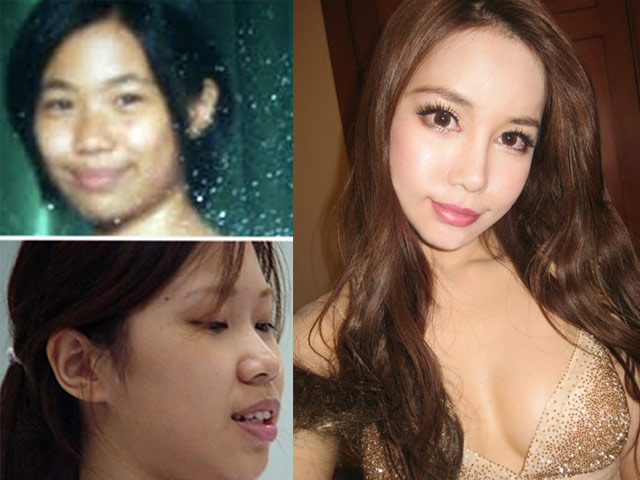 Thẩm mỹ viện - Lộ ảnh cũ kém xinh của hot girl sexy nhất Singapore