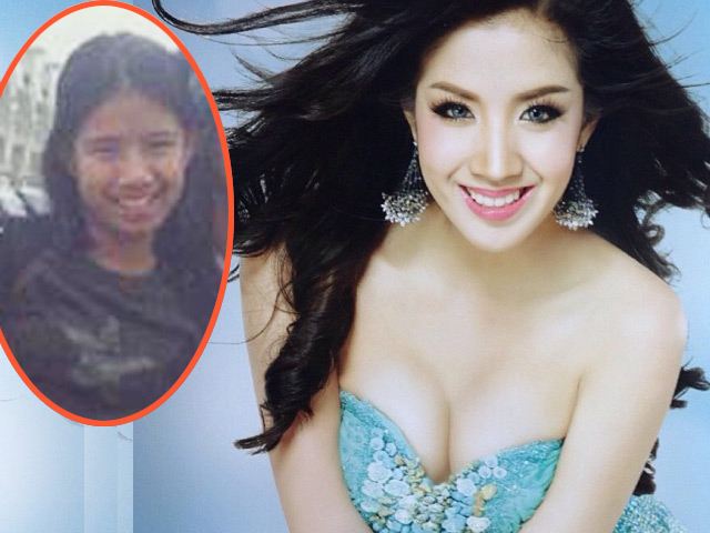 Thẩm mỹ viện - Hoa khôi làng nhạc Thái "vịt bỗng hóa thiên nga"