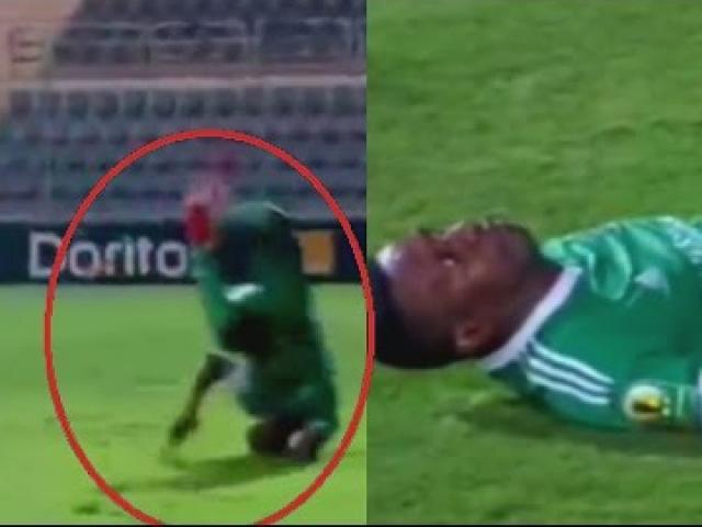 Bóng đá - Ngã gãy 5 đốt xương, cầu thủ có nguy cơ tàn phế