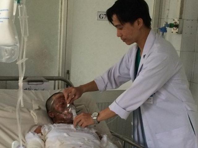 Pháp luật - Chồng chết, vợ nguy kịch vì tưới xăng tự thiêu