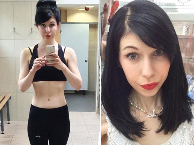 Bạn trẻ - Cuộc sống - "Nghiền" Facebook, cô gái trẻ rơi vào tình trạng biếng ăn