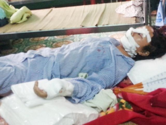 Pháp luật - Người chồng cắt gân chân - tay vợ phạm vào tội gì?