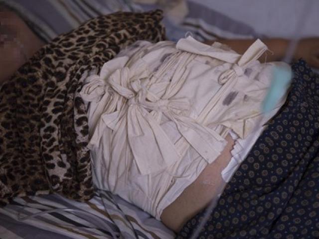 Phi thường - kỳ quặc - Người phụ nữ nuốt gần 1kg móng tay