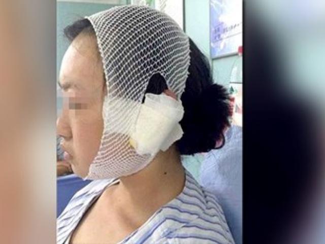 Phi thường - kỳ quặc - Cô gái bị cắn đứt tai vì đá thú cưng người khác