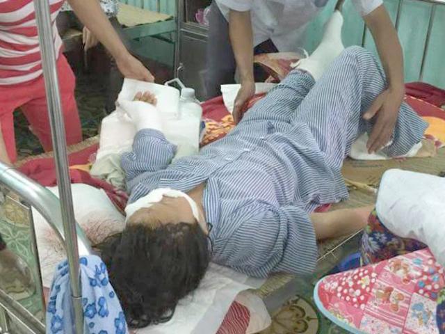 Vụ án nổi tiếng - Nghi can cắt gân tay - chân vợ ở Bắc Giang ra đầu thú