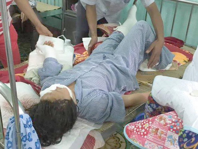 Pháp luật - Điều kiện để xử lý hình sự đối tượng cắt gân tay, chân vợ