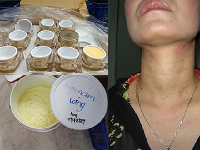 Thị trường - Tiêu dùng - Đáng sợ mỹ phẩm "công nghệ… tay chân"