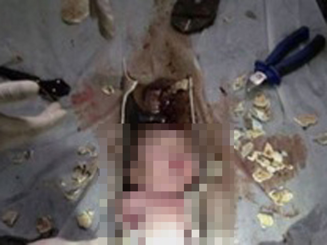 Tin tức trong ngày - Làm rõ vụ trẻ sơ sinh chết với vết đứt sâu ở cổ