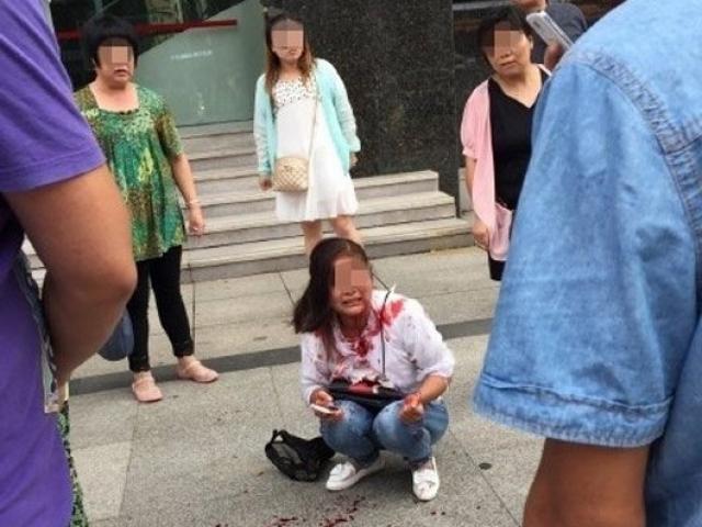 Bạn trẻ - Cuộc sống - Phẫn nộ chàng trai cắn đứt tai bạn gái vì mâu thuẫn