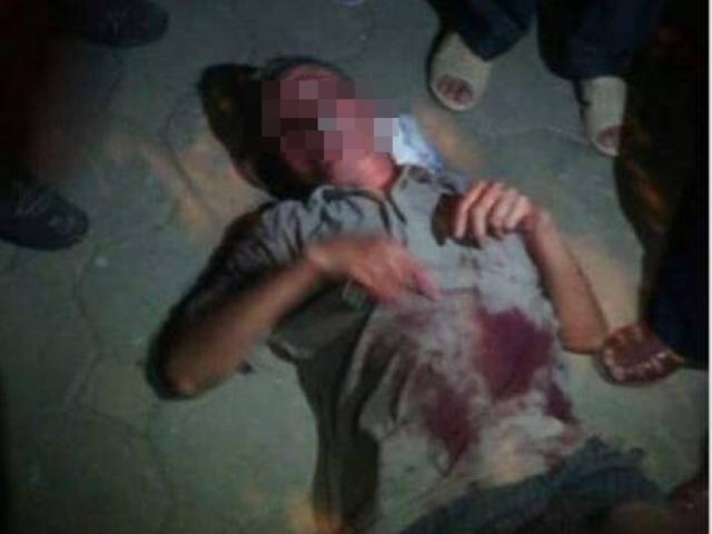 Pháp luật - Va chạm giao thông, thanh niên lao vào hành hung cụ già