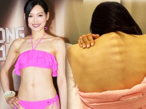 Bí quyết làm đẹp - Thí sinh Hoa hậu Hong Kong nhịn ăn, gầy như bộ xương