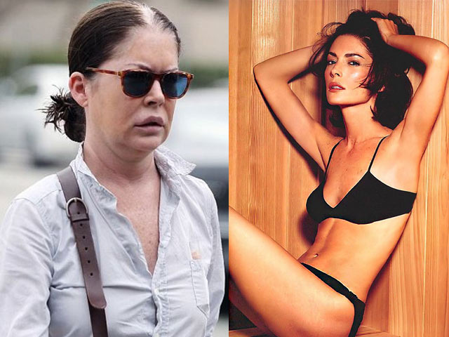 Làm đẹp - Cô đào Mỹ mặt phù nề vì lạm dụng "dao kéo"