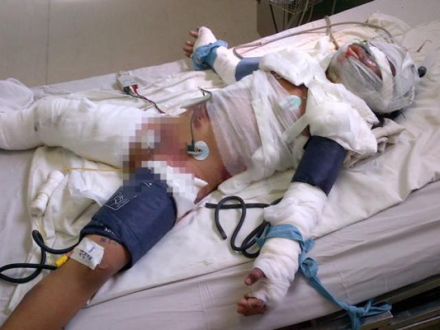 Pháp luật - Bán vé số không hết, bé gái bị mẹ đổ xăng đốt