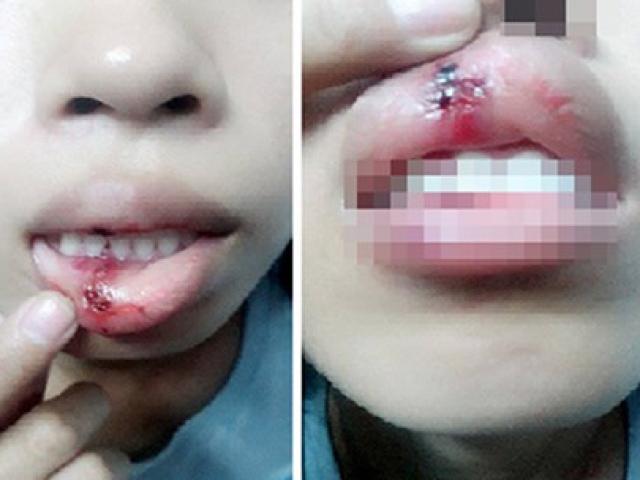 Tin tức trong ngày - Xác minh clip "dập môi vì đòi CSGT giải thích"