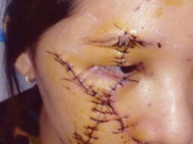 Pháp luật - Nữ tiếp viên bị rạch mặt vì "nẫng" khách của đàn chị