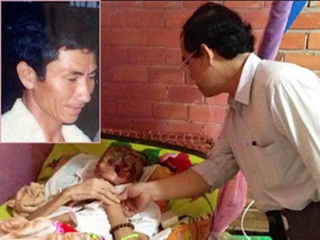 Sức khỏe đời sống - "Bệnh lạ "ăn" tới đầu chồng tôi rồi’!