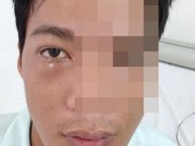 Một bệnh nhân bị "ăn mặt" điều trị thành công
