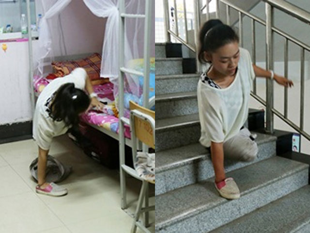 Bạn trẻ - Cuộc sống - Cô gái 19 tuổi cụt chân một mình chống chọi với cuộc sống