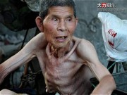 Nhịn đói để sống trường thọ và cái kết đau đớn cho cụ ông 60 tuổi