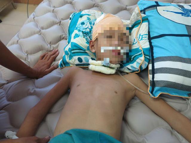 Trọng án - Vụ bác đánh 2 cháu thương vong: Bé trai vẫn nguy kịch
