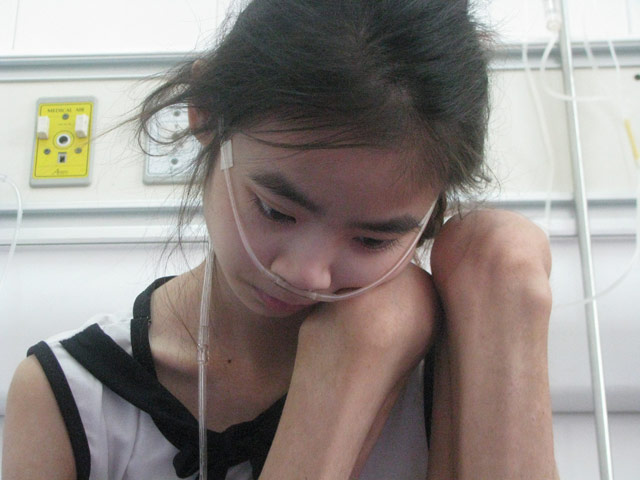 Tin tức Việt Nam - Trung thu của cô bé suy phổi: “Em ước tự thở được”