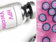 Sức khỏe đời sống - Hàng ngàn người Mỹ ân hận vì tiêm vắc xin HPV: Bác sĩ nói gì?