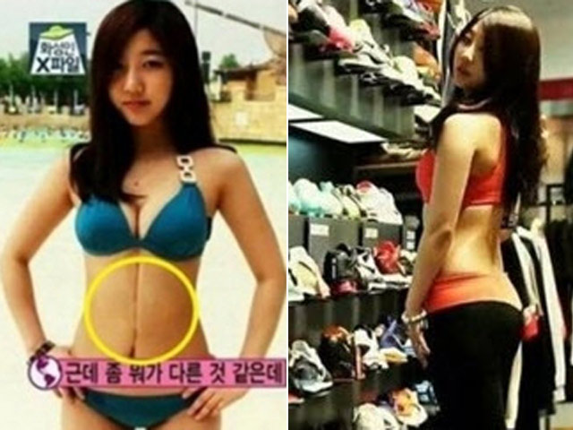 Giới trẻ - Vết sẹo dài trên bụng mỹ nữ và sự thật bất ngờ