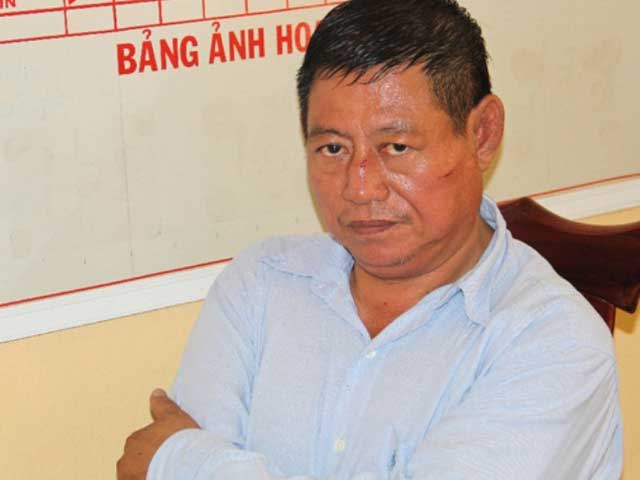 Pháp luật - Nạn nhân bị trung tá Campuchia bắn đã được cứu sống