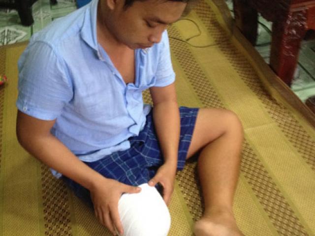 Tin tức trong ngày - Vụ bệnh nhân bị cưa chân: Bộ Y tế yêu cầu xử lý nghiêm