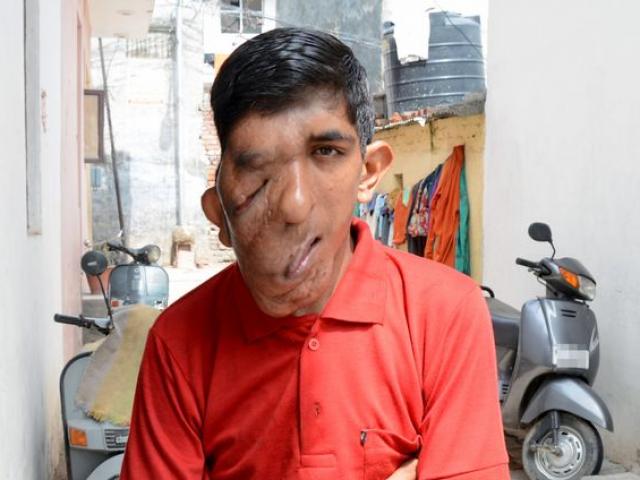 Phi thường - kỳ quặc - Thanh niên Ấn Độ có khuôn mặt của thần đầu voi