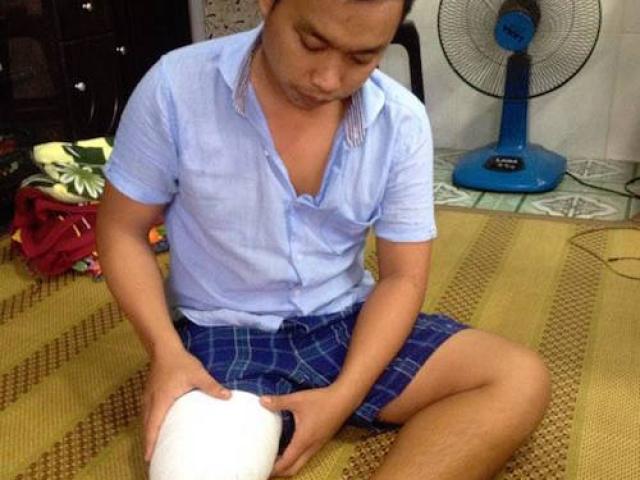 Tin tức trong ngày - Vụ bệnh nhân bị cưa chân ở TP.HCM: Hòa giải bất thành