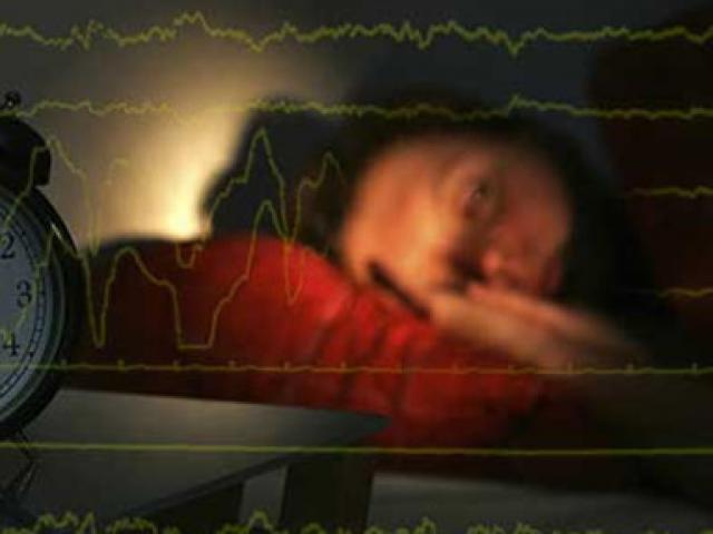 Ngủ quá nhiều hay quá ít đều tăng rủi ro đột quỵ