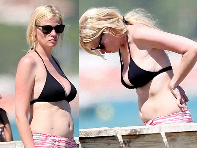 Người mẫu - Hoa hậu - Siêu mẫu Hà Lan gây sốc vì vòng eo "bánh mì"