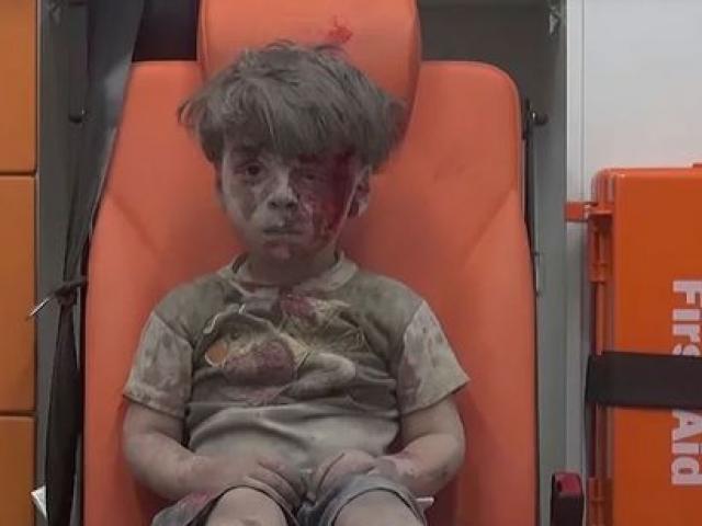 Thế giới - Hình ảnh bé trai Syria nhem máu rung động cả thế giới