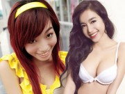 Bạn trẻ - Cuộc sống - Tu sửa hàm răng giúp hot girl Việt đẹp lên bội phần