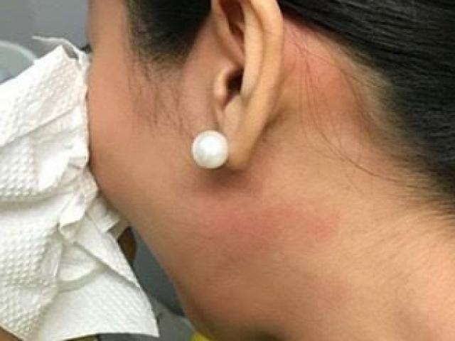 Tin tức trong ngày - Tiếp viên bị chấn động tâm lý sau cú ra đòn của khách VIP