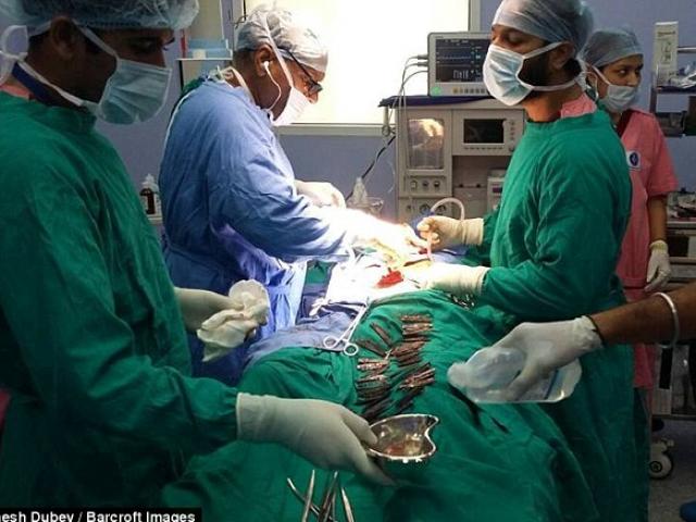 Phi thường - kỳ quặc - Rợn gáy với dị nhân nuốt 40 con dao vào bụng