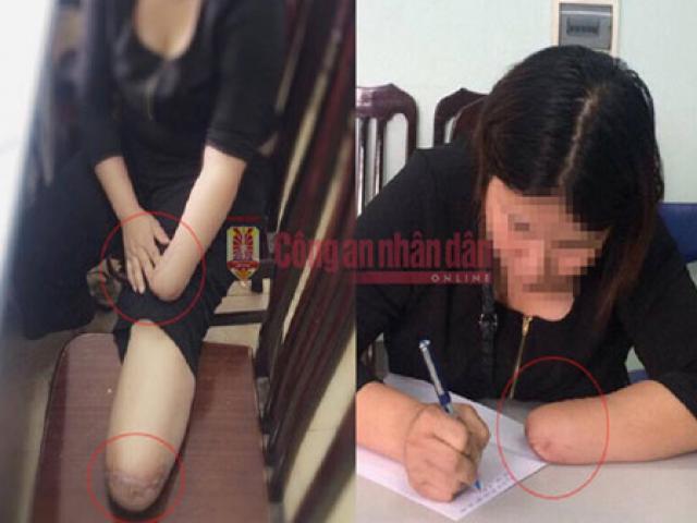 Tin tức trong ngày - Vụ chặt chân tay để lấy bảo hiểm: Người thân nói gì?