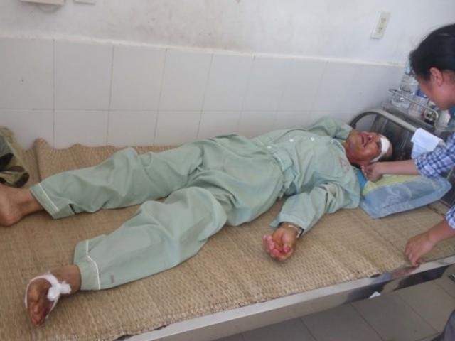 Tin tức trong ngày - Người đi đường bị máy bay L39 gặp nạn lao trúng kể phút cận kề cái chết