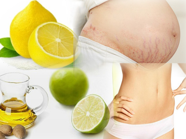 Làm đẹp - Chanh tươi khiến vết rạn da phải "lầm lũi ra đi"