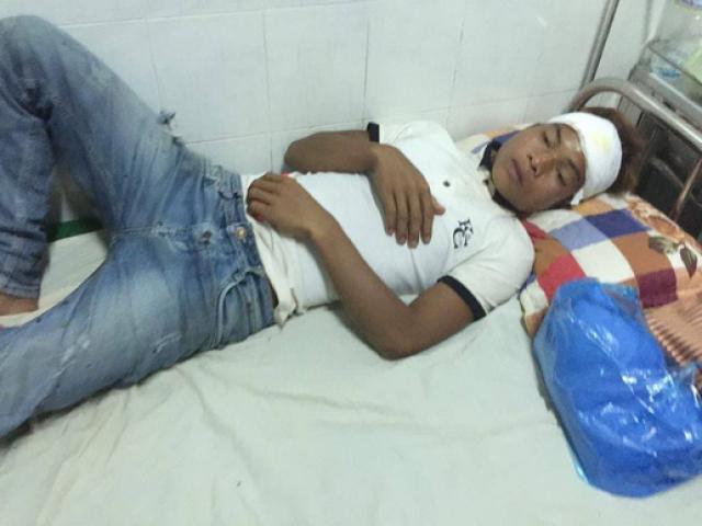 Pháp luật - Bị gần chục đối tượng vây đánh vì… nhìn mặt láo