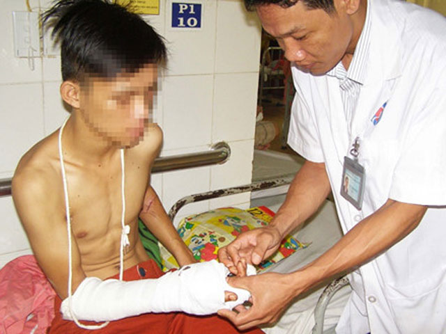 Tin tức trong ngày - Bỏ quên bàn tay đứt lìa ngoài hiện trường tai nạn