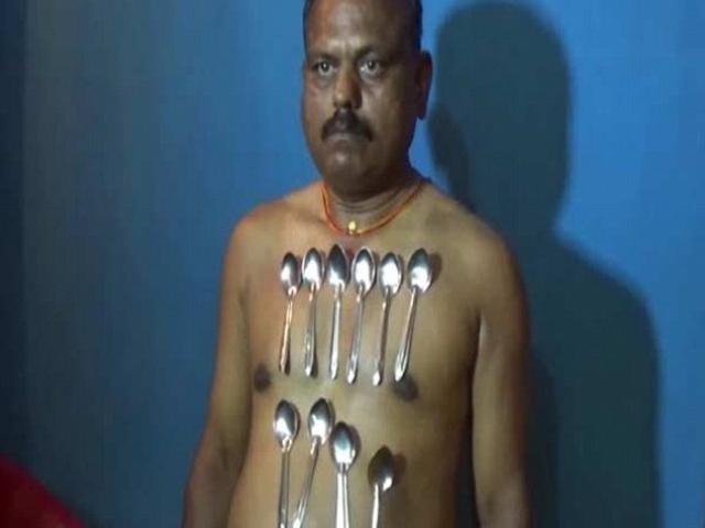 Phi thường - kỳ quặc - Bị ném thìa vào lưng, phát hiện khả năng hút dính 10 kg kim loại