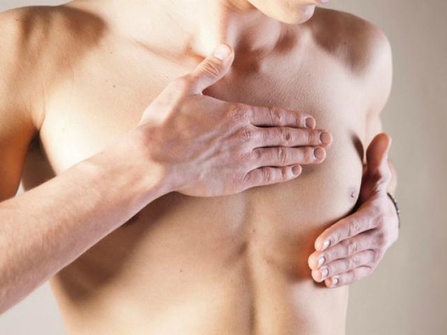 Sức khỏe đời sống - Bất ngờ với những dấu hiệu ung thư vú ở nam giới
