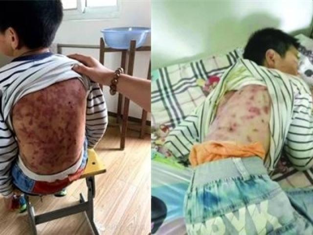 Bạn trẻ - Cuộc sống - TQ: Cha dượng đánh đập con trai tàn nhẫn gây phẫn nộ